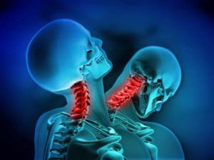 Whiplash o Colpo di frusta, cos’è e come si può trattare?